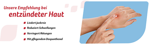 FENIHYDROCORT Krēms 0,5%, 30 g