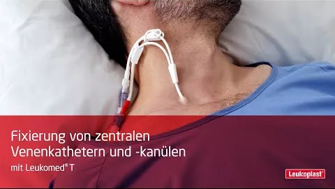 Video par Leukomed transp.sterili plāksteri 15x20 cm, 50 gab