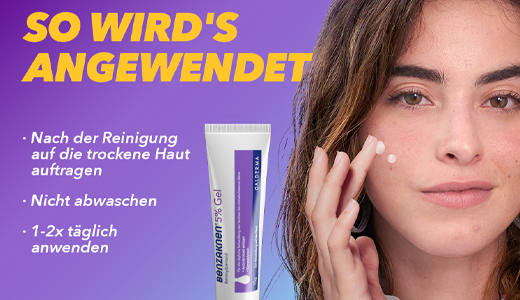 BENZAKNEN 5% gēls, 2X40 g