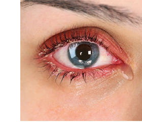 EVOTEARS Omega acu pilieni, 3 ml