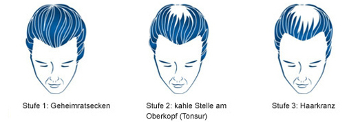 REGAINE Vīriešu putas 50 mg/g, 3X60 ml