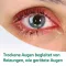 EVOTEARS Omega acu pilieni, 3 ml