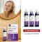 MINOXIDIL DoppelherzPharma 20 mg/ml šķīdums sievietēm, 3X60 ml